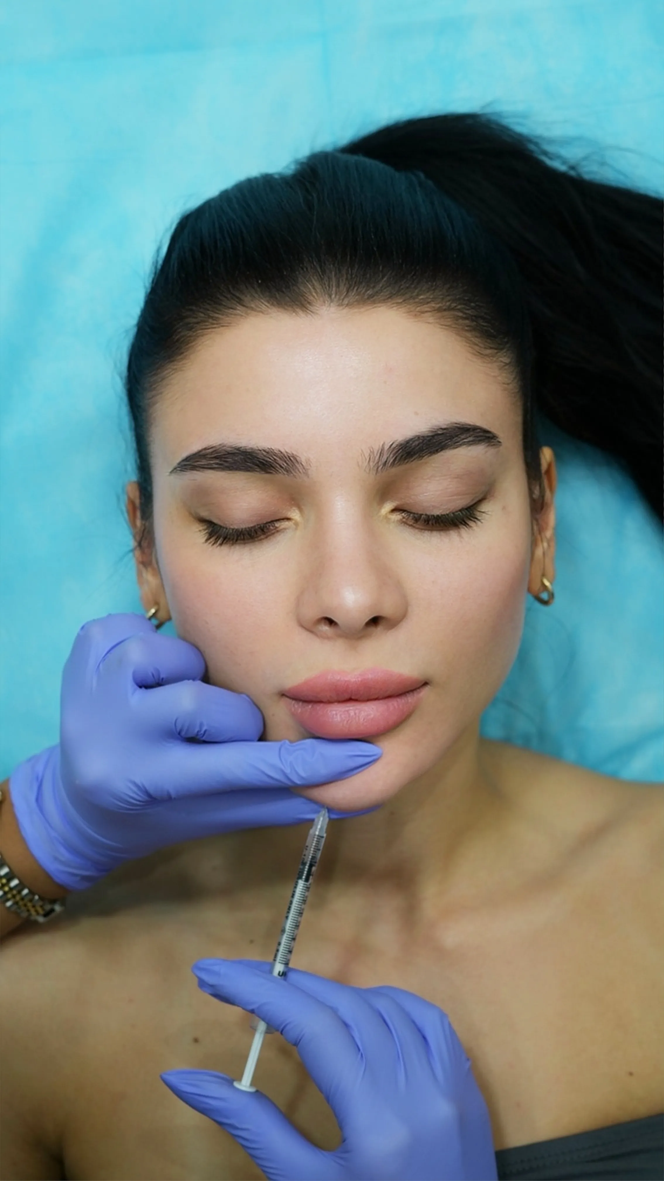 Young woman receiving chin filler injection for facial contouring at aesthetic clinic