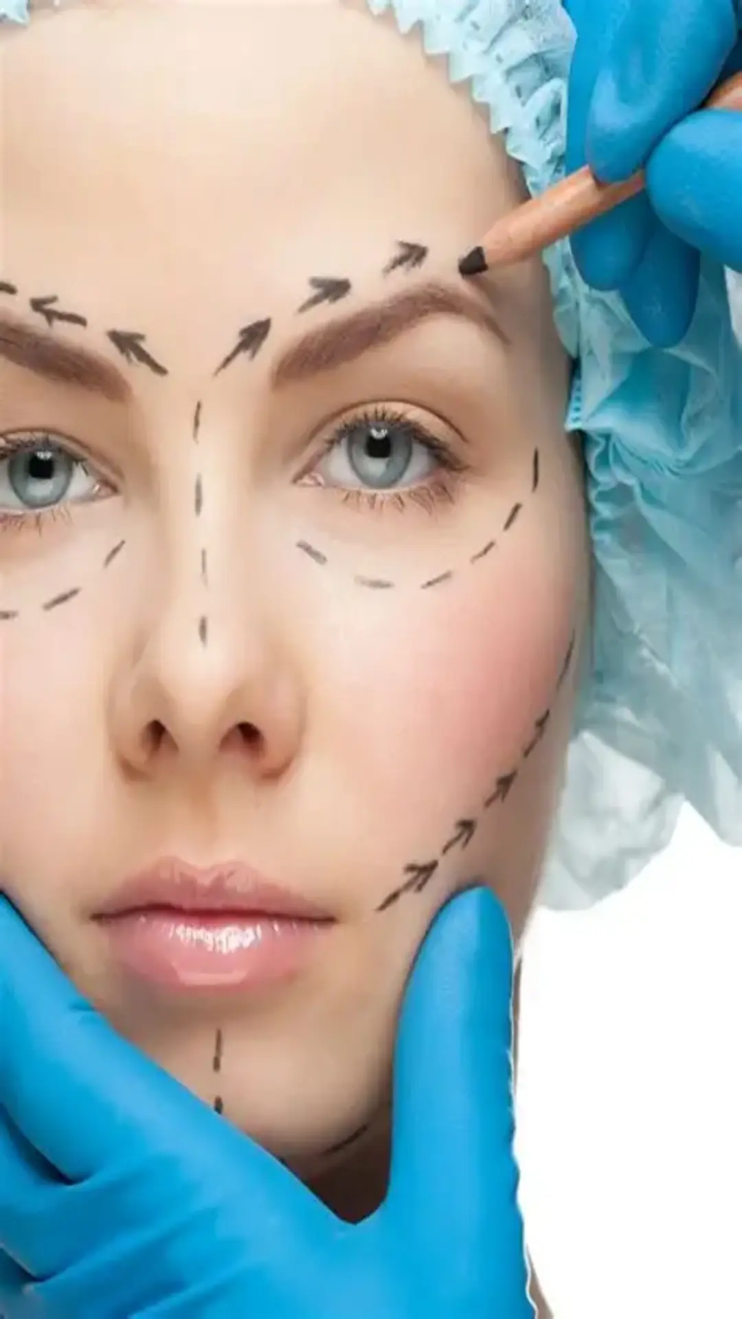 Close-up of woman’s face marked for plastic surgery with gloved hands and pencil