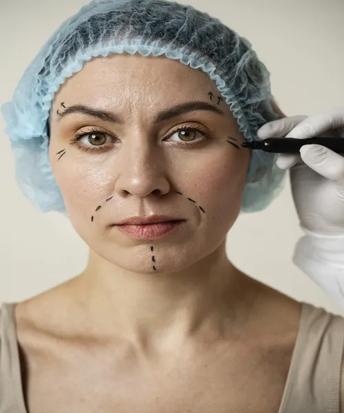 Mature woman with surgical markings on face before plastic surgery consultation